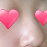 <b>코</b> <b>끝</b> 둥근거 짜증나 ㅠㅠ
