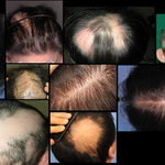 탈모짜장면배달원아저씨