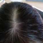 나보다 머리 숱 없는 애 있냐?
