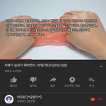 액괴유튜버 <b>자해</b>한다는게 자랑이냐