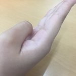 <b>손등</b> 손바닥 색 차이 나는 사람...
