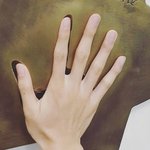 거기 길이가 너무 길어서 수술이 고민이에요 (장난<b>x</b> 답변해주실분)