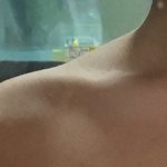 [드루와] 나 ㄹㅇ 승모근+어깡 <b>끝판</b>왕임