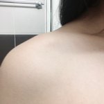 <b>진자</b> 나 승모근 개심해ㅜㅜ