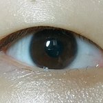 나 <b>눈성형</b> 뭐뭐해야되냐