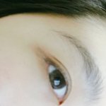 <b>쌍수</b> <b>후</b> 사진이다!