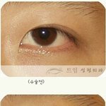 [댓글부탁해] 앞트임<b>오진</b>다 하고싶음나도