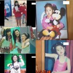 [박기량쌍수] <b>기량</b>눈꺼풀