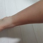 <b>발목</b>색 나보다 심한애 있냐