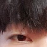 남잔데 내눈 쌍커<b>풀</b>수술어때??