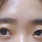 나보다 심한 <b>짝눈</b>있음?