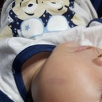 불쌍한우리아이 어떻게 하나요? 사진있음