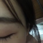 나 <b>눈</b> <b>옆</b>에 점 졸라 거슬리는데