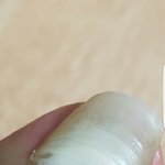 [댓글부탁해] 내 <b>발톱</b> 뽑히려고함..왜이래이거