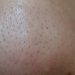 존12나 혐 얘들아 코팩하고 모공에 빵구 뚤린거 어쩔까