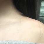 나 승모근 <b>심해</b>?