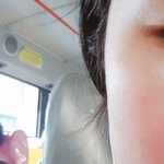 웃으면 <b>얼굴</b>형 <b>개</b>이상해짐
