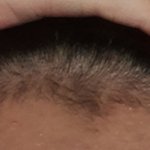 [드루와] 너넨 헤어라인 <b>밀지</b>마라 ㅈㅂ