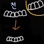 [댓글부탁해] 교정하는애들아 <b>앞니</b>