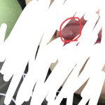 <b>아오</b> 혀에 구내염 났는데 어떡함 ( 혐오주의