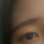 나 쌍액<b>전후</b> 봐줘 쌍수 고민임ㅠㅠ