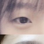 [댓글부탁해] 내 쌍수<b>전후</b>야....