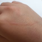 엄마한테 맞았어