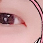 [드루와] 쌍수 1년 어때 사진ㅇ