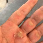 [다이어트] 다이어트 힘들지?