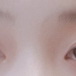[조언부탁해] 코<b>성형</b>해야할까,,???