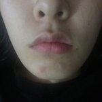 [드루와] 나만큼 <b>하관</b>못생긴사람있어??