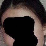 <b>사각</b>턱 심해?