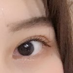 [드루와] 나 눈 <b>충혈</b>된 거 결막염이야?