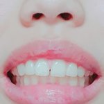 [조언부탁] <b>치아</b>교정 가능할까요ㅠㅠㅠㅠ?