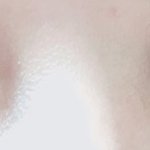 나 렌즈 훌라 <b>심해</b>?