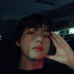 보톡스 윤곽<b>주사</b> 필러 맞아본애들 들어와주라ㅠㅠ