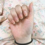 톡선에 <b>손톱</b>보고 왔는데 내 <b>손톱</b>도ㅠㅠㅠ