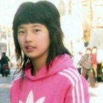 [수지성형] ㅅㅈ 눈 코 <b>치아</b> 틀린