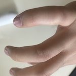 이거 <b>흉터</b> 어캄