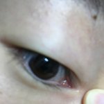 [댓글부탁해] <b>눈</b>에이상한거<b>남</b> ㅠㅠ머야