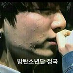 방탄 여드름 <b>갯수</b> 세기 대회