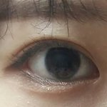<b>눈</b> <b>밑</b>에 오돌토돌하게 나는거 뭔지 아는 사람 ㅜㅜ