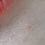 [조언부탁해] 나 피부 왜이래ㅠㅠㅠㅠㅠㅠ