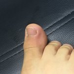 나 <b>상처</b> 만지는 거 좋아하는데