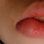 [드루와] 자고일어나니까 입술 ㅈㄴ<b>부음</b>