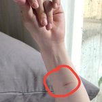 [모두드루와] 이창섭 팔에 <b>상처</b>뭐야??