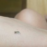 [댓글부탁해] 목긁었는데 나온 <b>때사진</b>