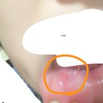 [드루와] 이게 <b>입병</b>이야??
