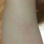 [댓글부탁해] 몸에 이거 왜생기는<b>거야</b>??????