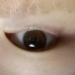 쌍수하면 어떨것같아??